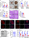 TRAPα-βKO impairs PPI translocation and decreases INS production but does n
