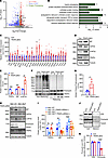 TRAPα is important for β cell ER function, and its deficiency causes PI mis
