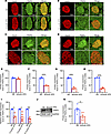 An HFD downregulates TRAPα expression in mouse islets.