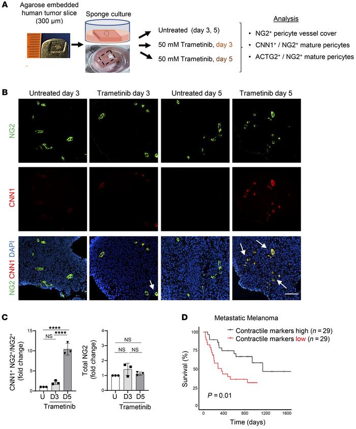 Pericyte phenotype switching is inducible in human cancer and correlates...