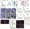 PEX5 loss impairs Apoe expression, aggravating lipid droplet burden and pro