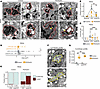 PEX5cKO phagocytes exhibit intralysosomal crystals and cytosolic curvilinea