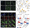 Exacerbated GAL3 response and lysosome turnover in PEX5cKO DMAMs.