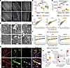 PEX5 deficiency in microglia impairs myelin-debris clearance and remyelinat