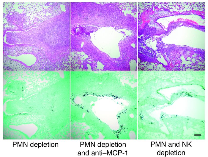 Effect of NK cell depletion or MCP-1/CCL2 neutralization on lung histolo...