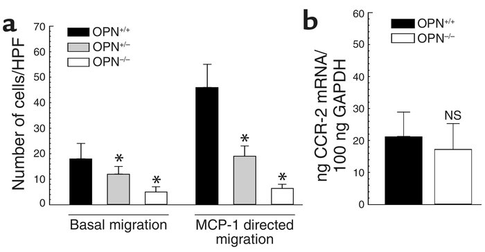 Transwell migration and CCR-2 expression of OPN+/+ and OPN–/– leukocytes...