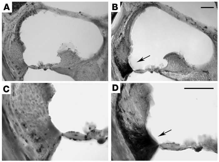 Inner ear inflammatory infiltrates are associated with onset of EAHL. Co...