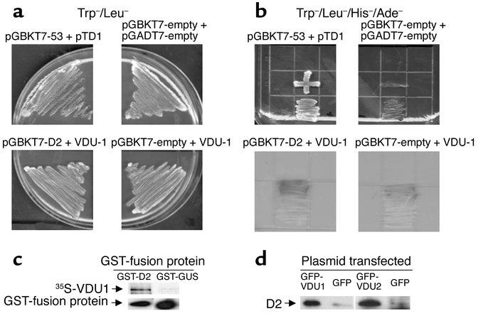 Yeast two-hybrid mating for pGBKT7-D2 and VDU1-expressing clone. (a and ...