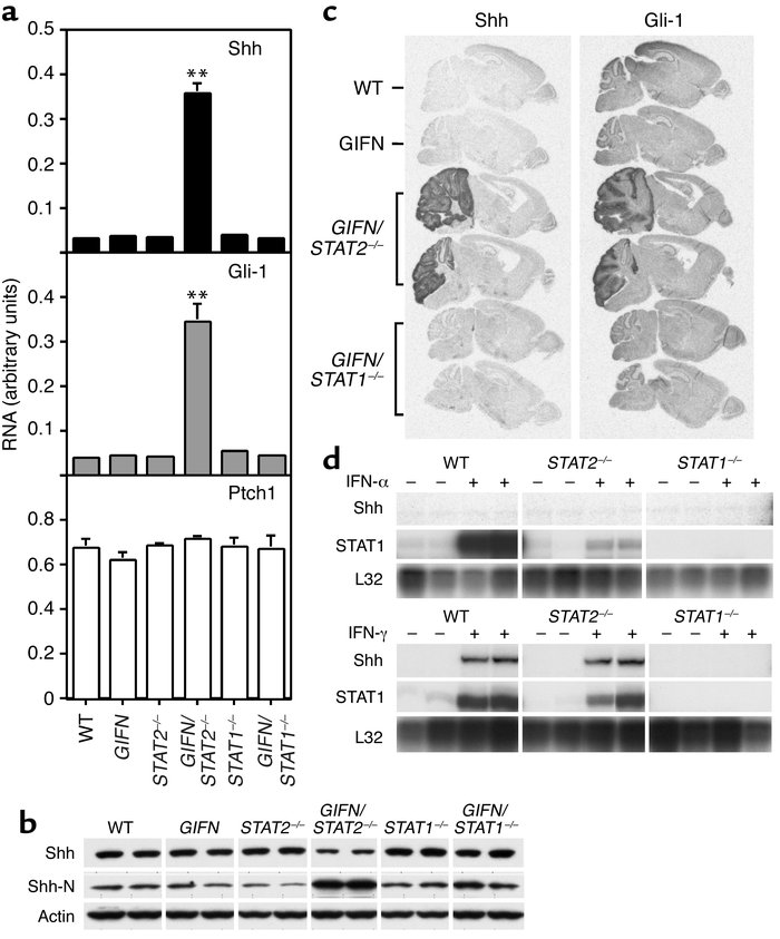 Activation of the Shh signaling pathway. (a) RNase protection analysis o...