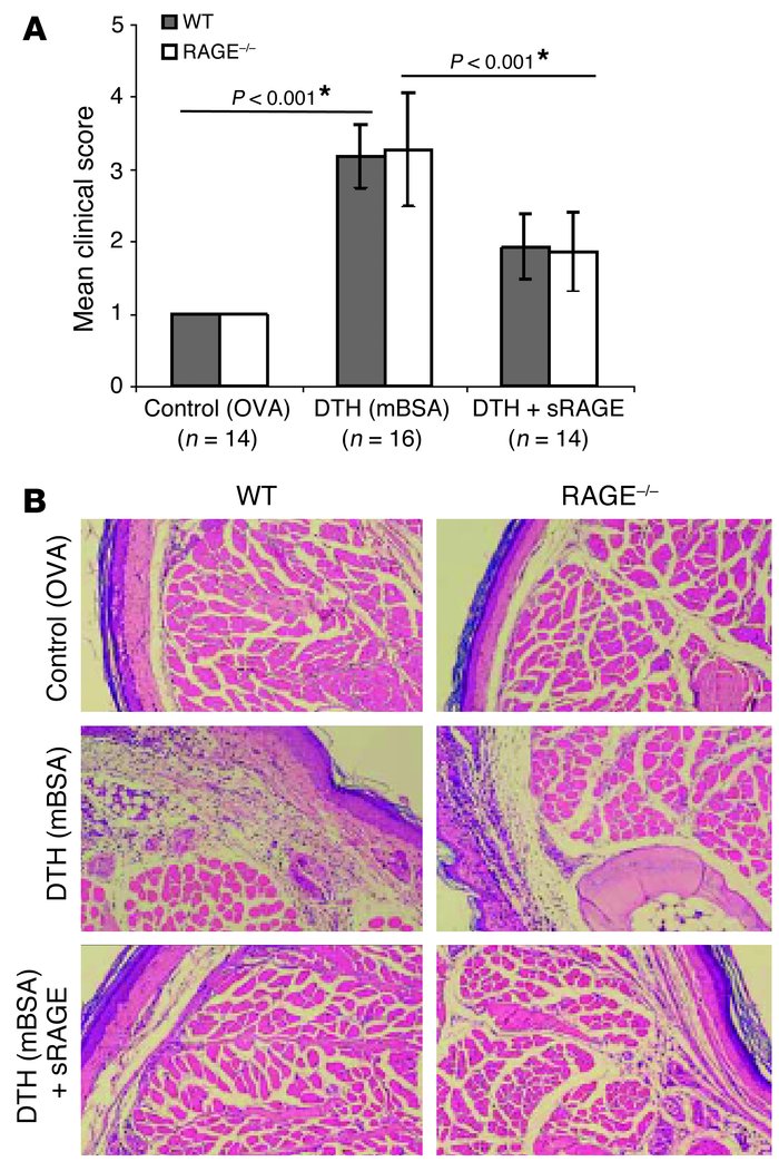 RAGE–/– mice display normal inflammation in a model of DTH, and applicat...