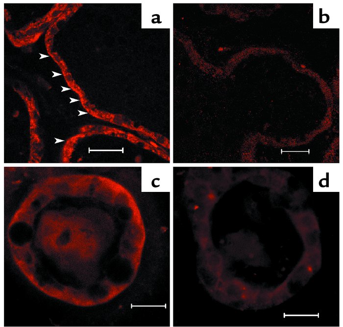 Immunofluorescence staining for the CaR in mammary glands of lactating m...