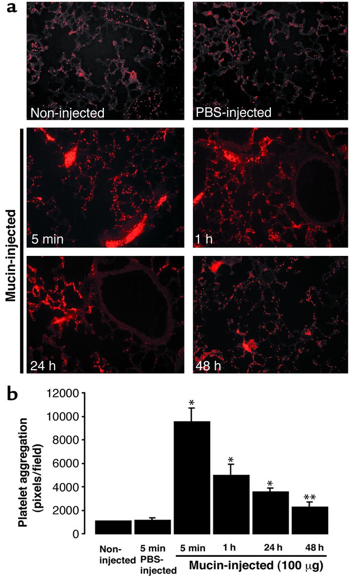 Time-course of platelet-rich microthrombi in wild-type mouse lungs follo...