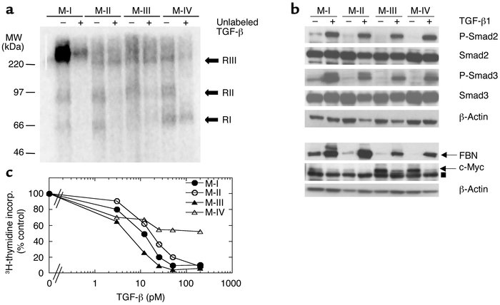 TGF-β receptor expression and responsiveness in the four human breast ep...