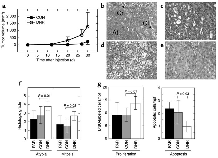 Decreased TGF-β responsiveness increases the tumor growth rate and histo...