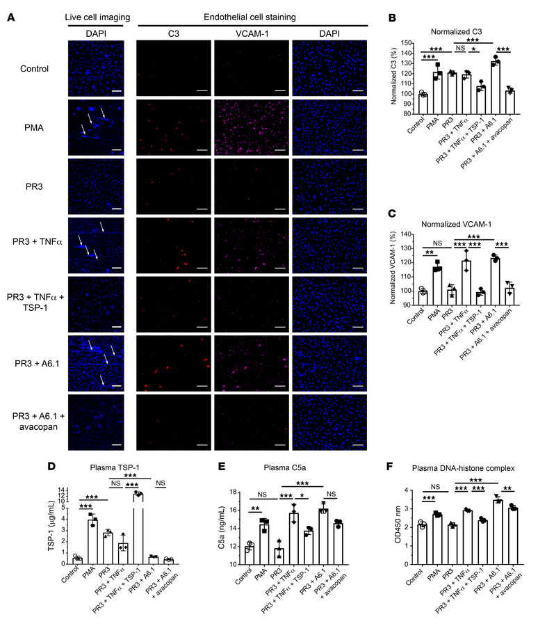 TSP-1 regulates complement activation and NET formation in an in vitro m...