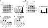 TSP-1 modulates complement at the C3 and C5 level of the complement cascade