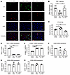 Knockdown of TSP-1 significantly increases deposition of C3 on activated en