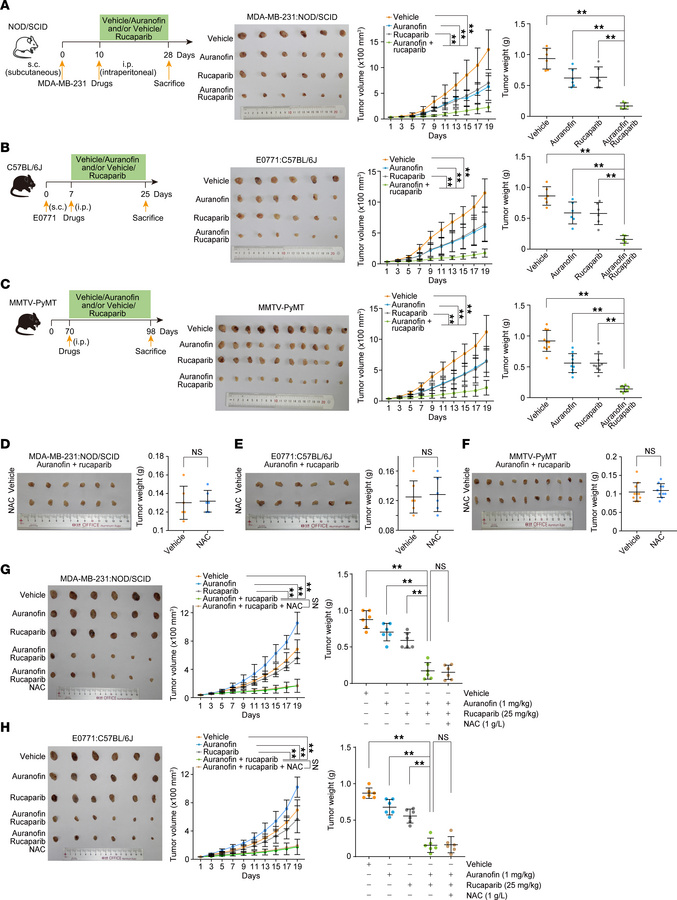 Breast tumor is synthetically susceptible to the action of auranofin and...