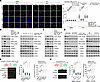 Auranofin impairs TOPBP1 recruitment and ATR activation.