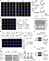 Auranofin prevents RPA loading to perturbed replication forks.