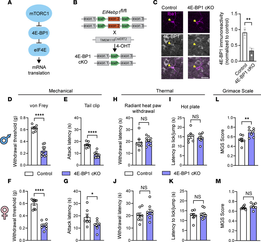 Increase in microglial translation induces mechanical pain hypersensitiv...