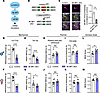 Increase in microglial translation induces mechanical pain hypersensitivity