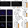 Phenotypic changes in microglia with enhanced translation.