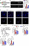 Downregulating translation in microglia attenuates microglial reactivity af