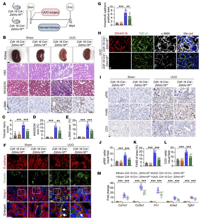 TEC-specific Zdhhc18 deficiency inhibits renal fibrosis induced by UUO i...