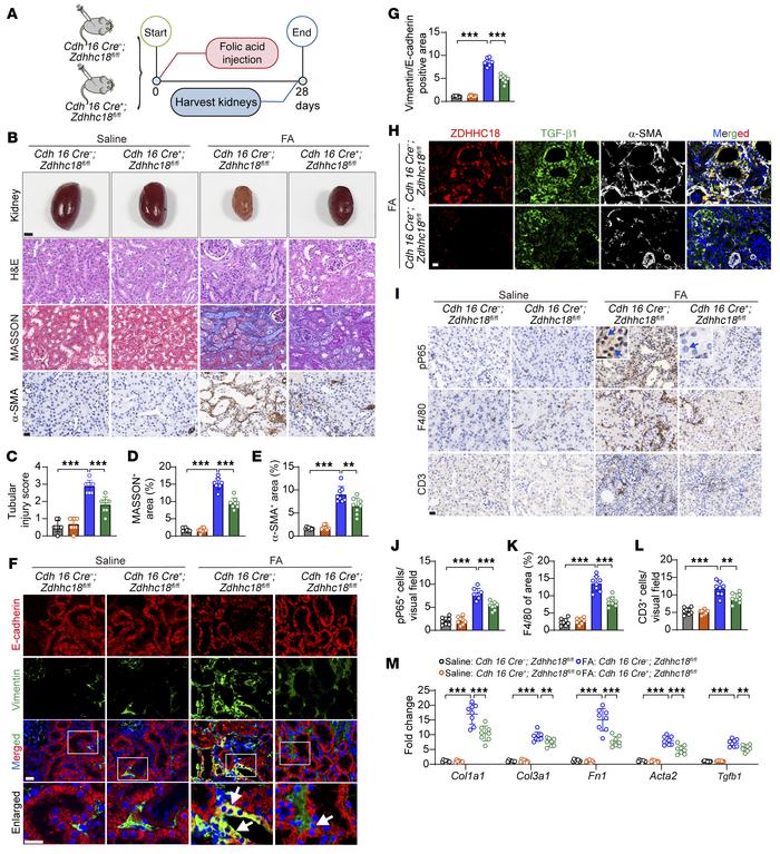 TEC-specific Zdhhc18 deficiency inhibits renal fibrosis induced by FA in...