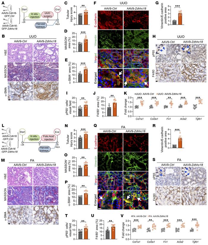 Overexpression of Zdhhc18 exacerbates renal fibrosis induced by UUO and ...