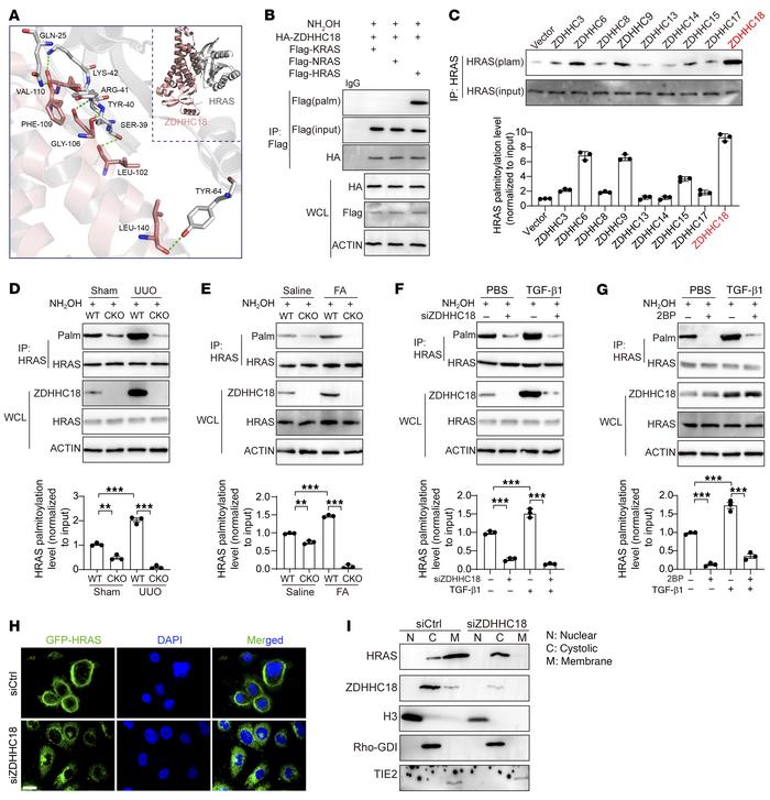 ZDHHC18-mediated HRAS palmitoylation regulates its plasma membrane local...
