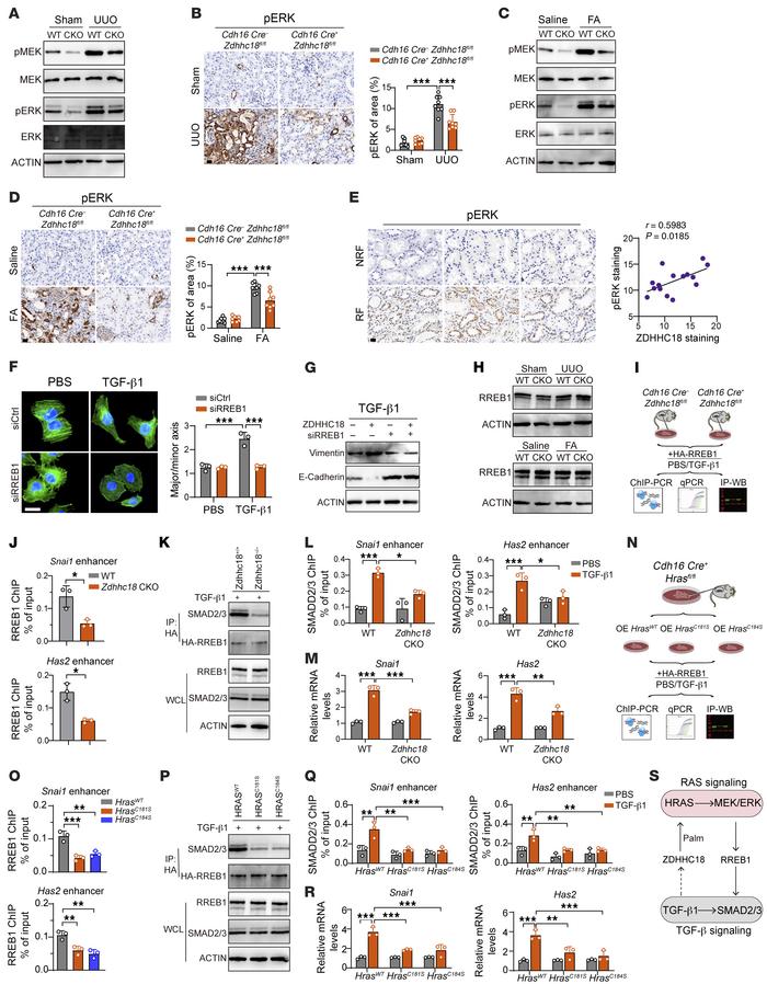 Palmitoylated HRAS–activated RREB1 recruits SMAD2/3 to the cis-regulator...