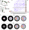 Impaired early T cell development in AR IL-7 deficiency.