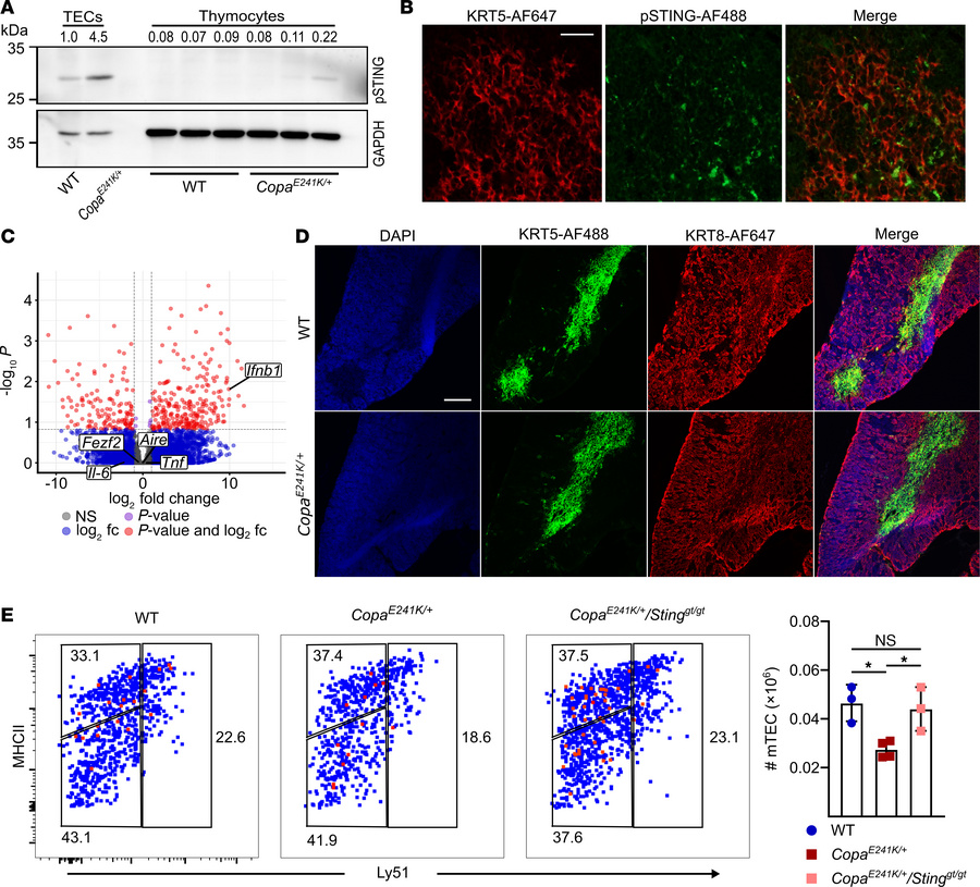 Activated STING in thymic stroma upregulates IFN signaling.
(A) Represen...