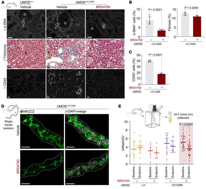 Therapeutic modulation of TMEDs mitigates inflammatory infiltrates and t...