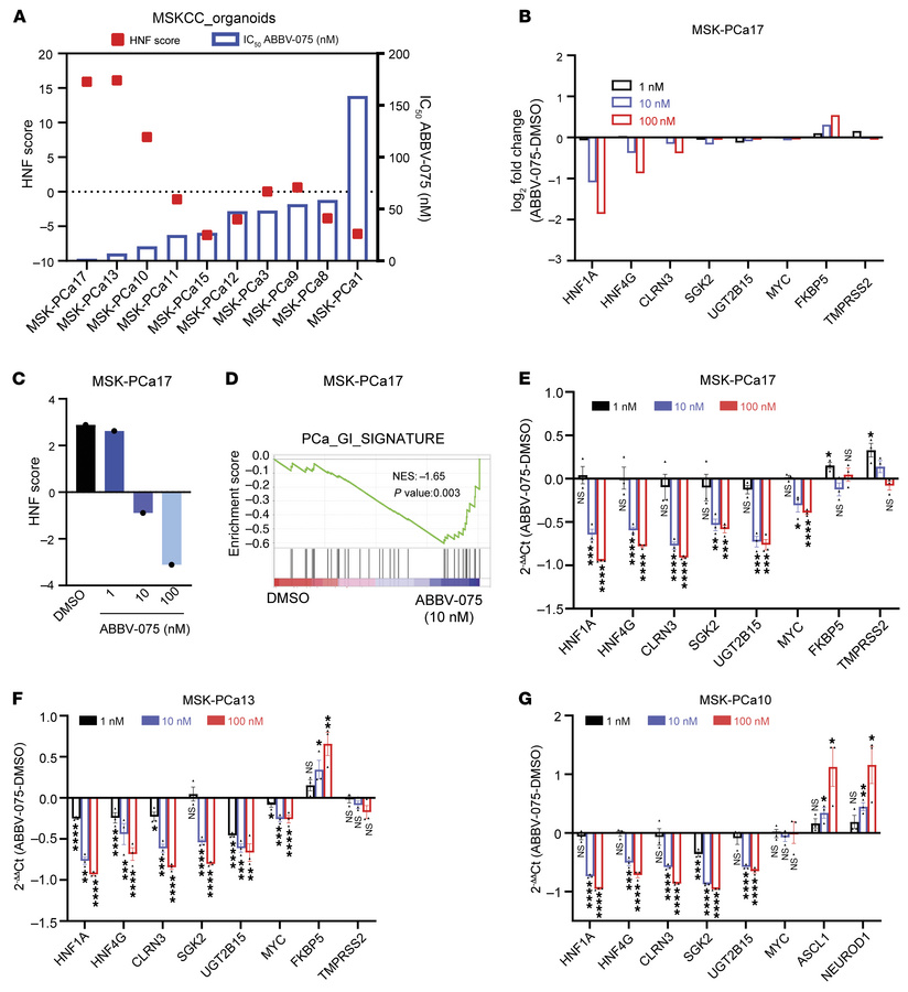 Patient-derived organoids with high HNF scores show increased sensitivit...