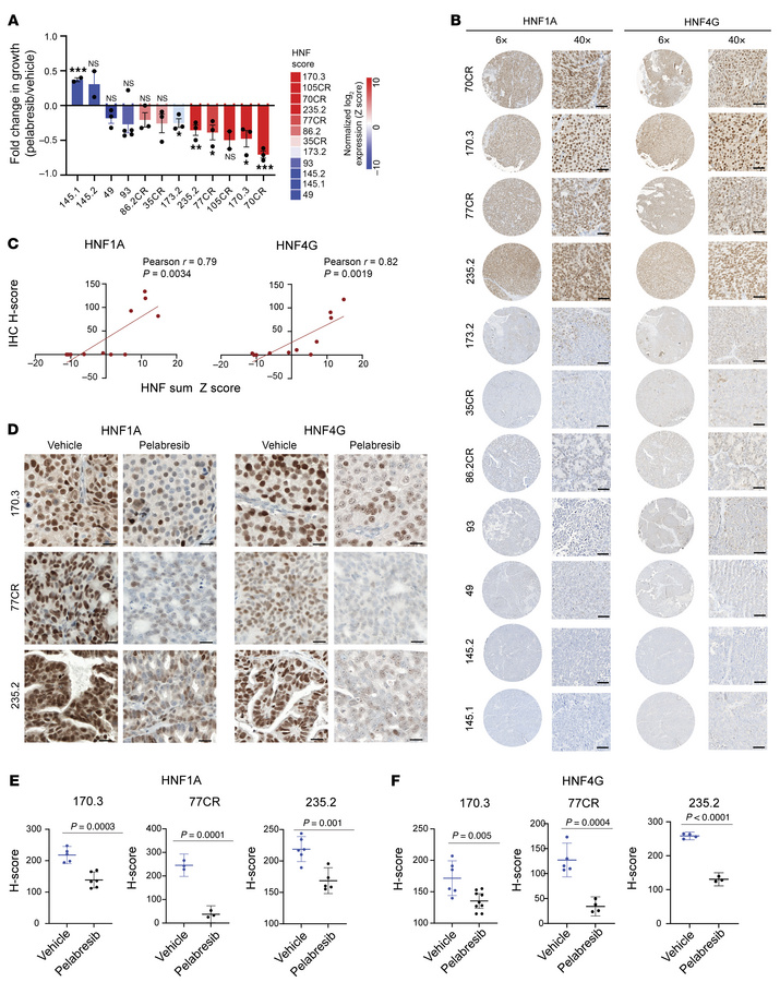 CRPC PDXs expressing high HNF score are sensitive to BET inhibition.
(A)...