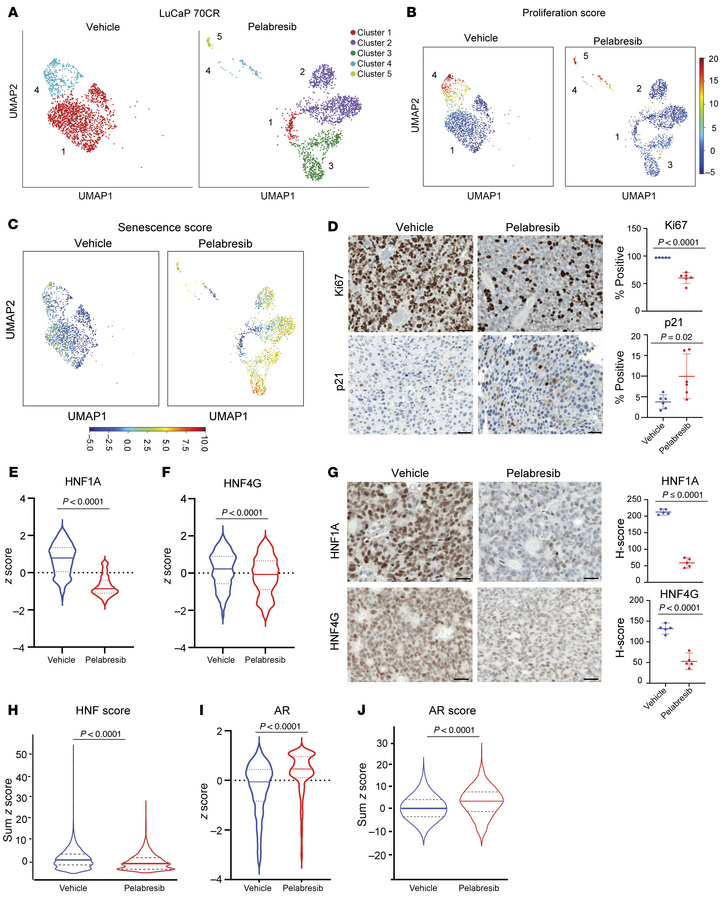 Pelabresib treatment inhibits proliferation and induces senescence in Lu...