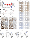 CRPC PDXs expressing high HNF score are sensitive to BET inhibition.