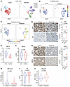 Pelabresib treatment inhibits proliferation and induces senescence in LuCaP