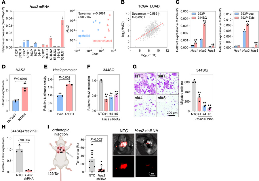 ZEB1 upregulates HAS2 expression.
(A) qRT-PCR of Has2 mRNA levels in epi...