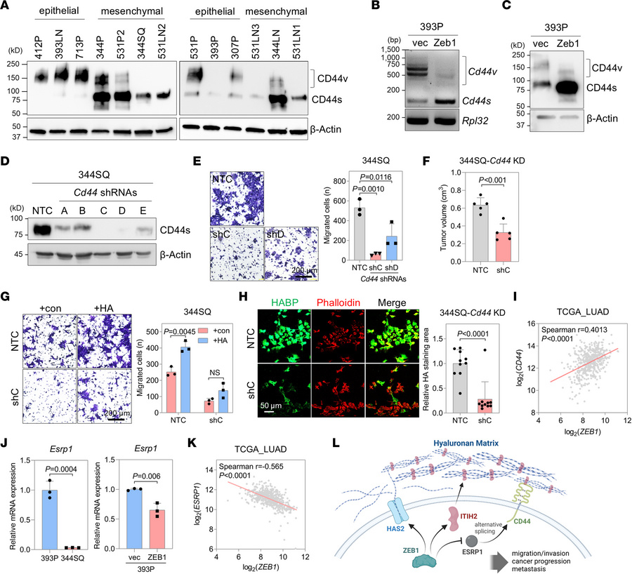 ZEB1 controls CD44 expression.
(A) Western blot of CD44 in epithelial-li...