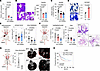 ITIH2 KD inhibits the migration and invasion of lung cancer cells.
