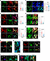 ZEB1 and ITIH2 facilitate the formation of the HA matrix and cables.