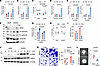 Mesenchymal-like cells are more sensitive to the HA matrix than epithelial-