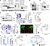 ZEB1 controls CD44 expression.