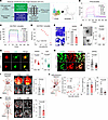 Sincalide, an ITIH2 inhibitor, inhibits the migration and invasion of lung