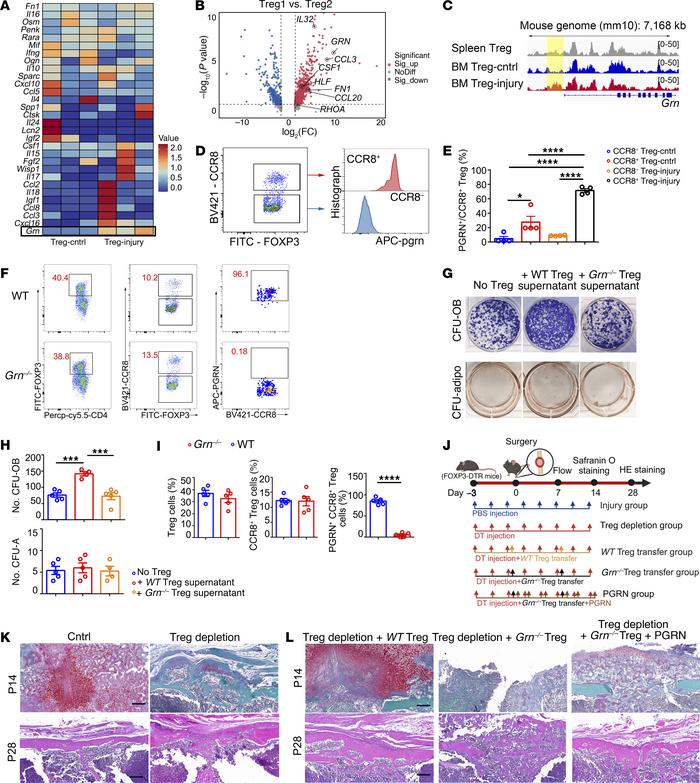Bone injury–responding Tregs display bone repair function dependent on s...