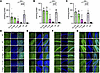 GM1 content storage in the CNS.